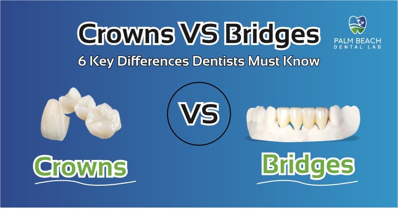 crowns vs bridges