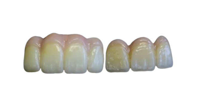 Premium Zirconia Crown