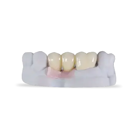 450X450 Implants And Custom Abutments 1