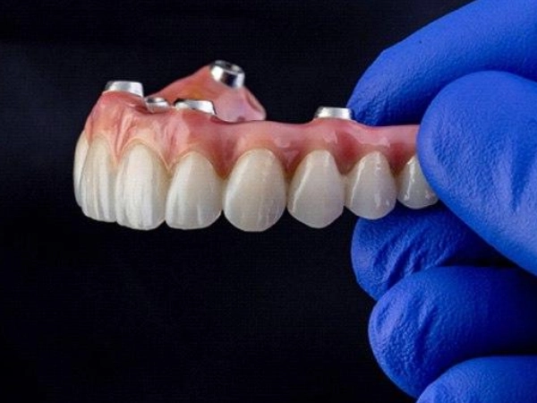 Built for Implant Restorations