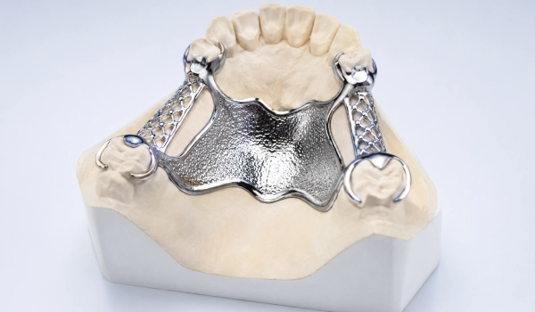 Cast Metal