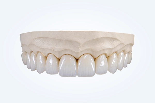 Multilayered Zirconia Crowns