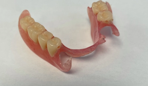 Temporary Partial Dentures