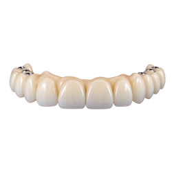 All on X Full Arches PMMA 2